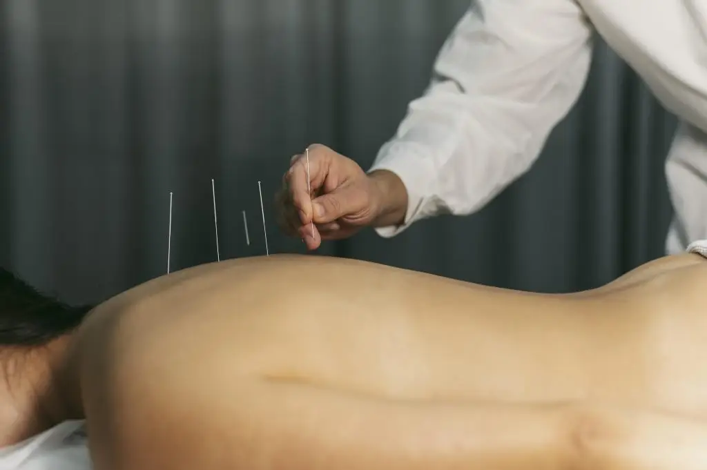 Acupuncturist in Bussum